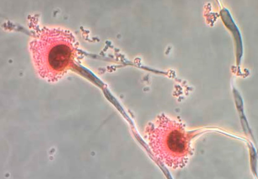 Nấm Aspergillus được cho là sẽ mở rộng phạm vi lây lan và ảnh hưởng khi Trái đất nóng lên. (Nguồn: CNN)