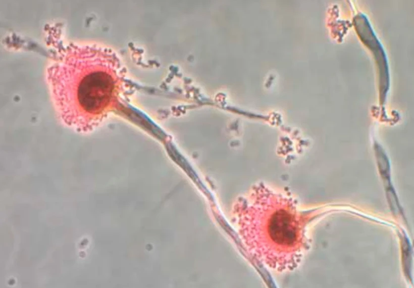 Nấm Aspergillus được cho là sẽ mở rộng phạm vi lây lan và ảnh hưởng khi Trái đất nóng lên. (Nguồn: CNN) Nấm Aspergillus được cho là sẽ mở rộng phạm vi lây lan và ảnh hưởng khi Trái đất nóng lên. (Nguồn: CNN)
