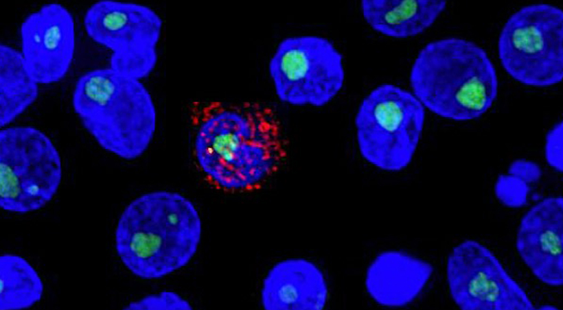 Nghiên cứu mới cho thấy thuốc lenacapavir có thể ức chế virus HIV trong cả năm. (Nguồn: Science.org)