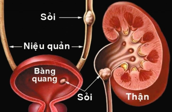 1710-soi-than-3.jpg