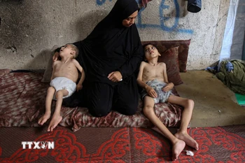 Trẻ em bị suy dinh dưỡng tại Dải Gaza. (Ảnh: THX/TTXVN)
