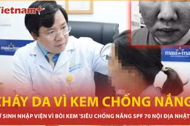 Nữ sinh cháy da vì bôi kem 'siêu chống nắng’ mua trên mạng 