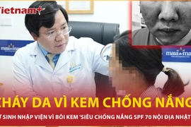 Nữ sinh cháy da vì bôi kem 'siêu chống nắng’ mua trên mạng 