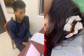 Công an triệu tập cha dượng trong vụ bạo hành bé gái lớp 5 ở Hà Tĩnh