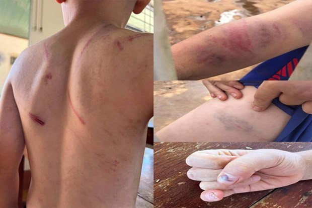 Kịp thời phát hiện nguy cơ bị bạo hành đối với trẻ em có cha mẹ ly hôn ảnh 1