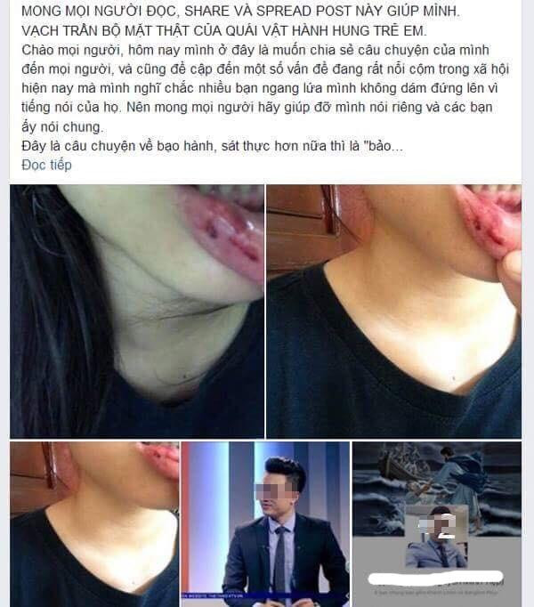 Đại biểu Quốc hội lên tiếng về vụ việc nữ sinh tố bị anh rể bạo hành ảnh 1