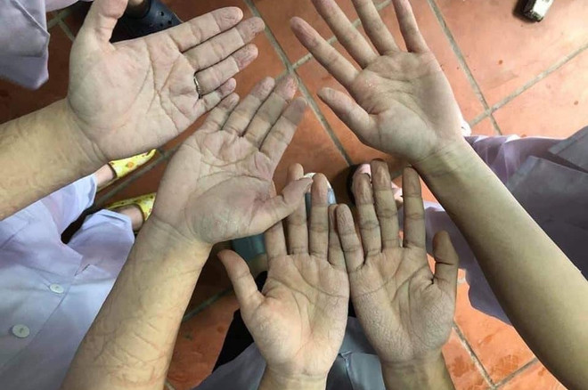 Sinh viên y dược và chuyến công tác đầu đời nơi tâm dịch COVID-19 ảnh 1