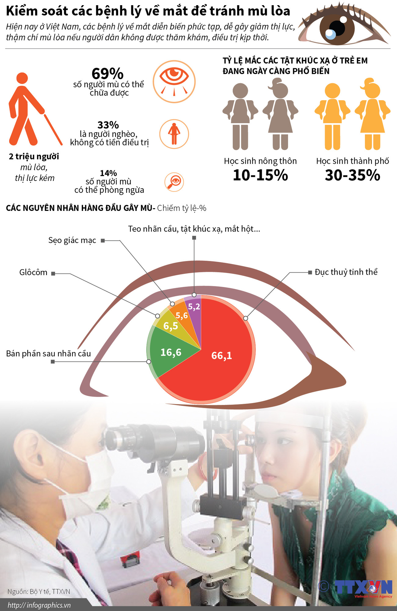 [Infographics] Kiểm soát các bệnh lý về mắt để tránh mù lòa ảnh 1
