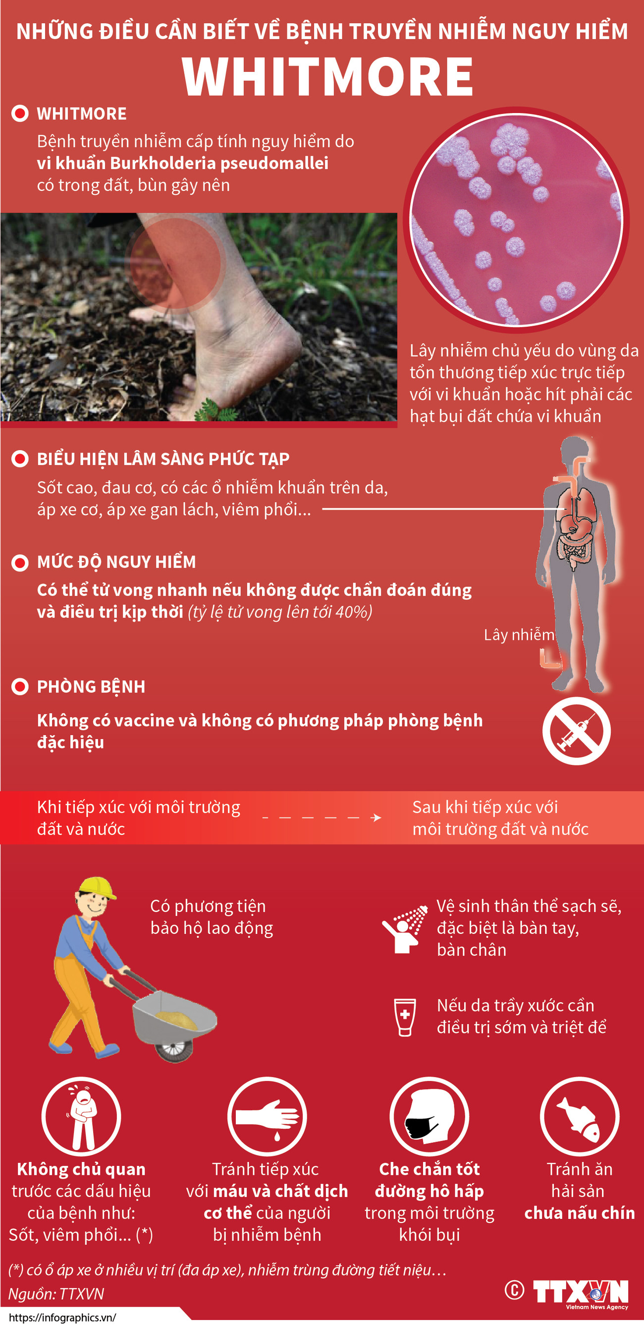 [Infographics] Những điều cần biết về căn bệnh nguy hiểm Whitmore ảnh 1