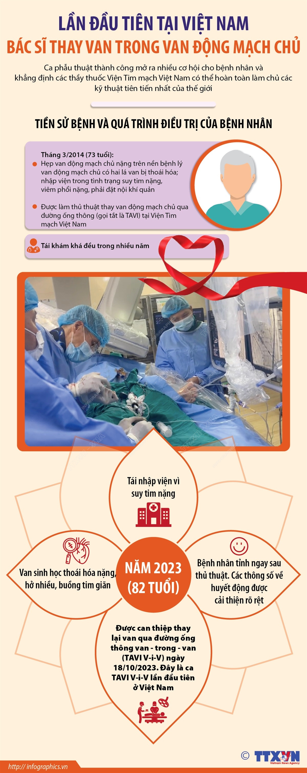 Thực hiện ca thay van trong van động mạch chủ lần đầu tiên ở Việt Nam ảnh 1