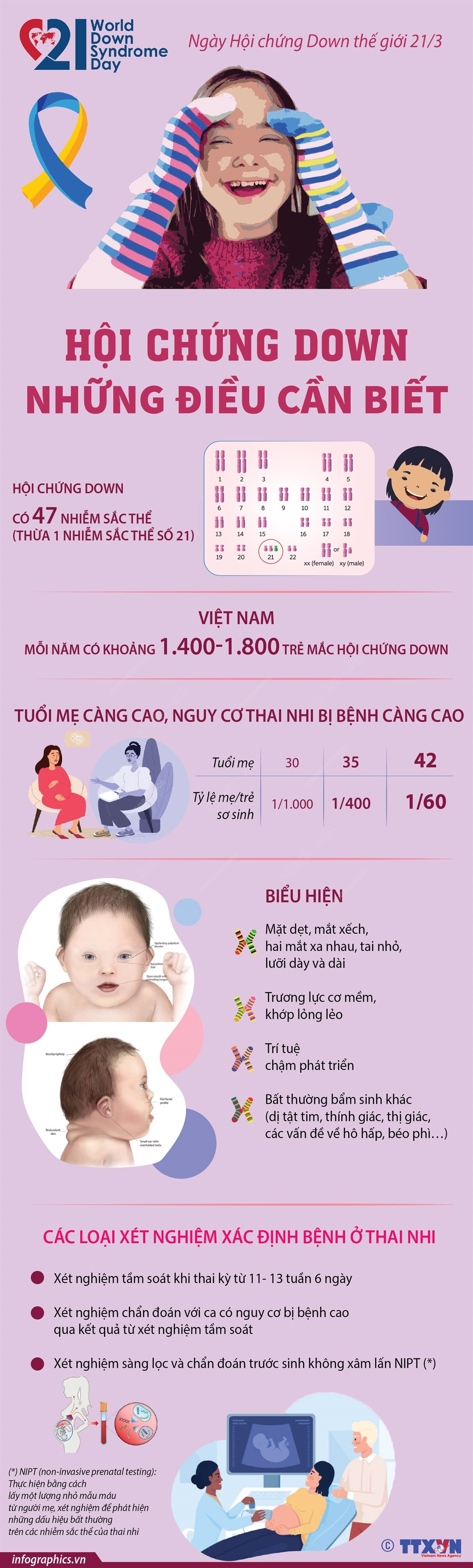 [Infographics] Những điều cần biết về hội chứng Down ở trẻ em ảnh 1