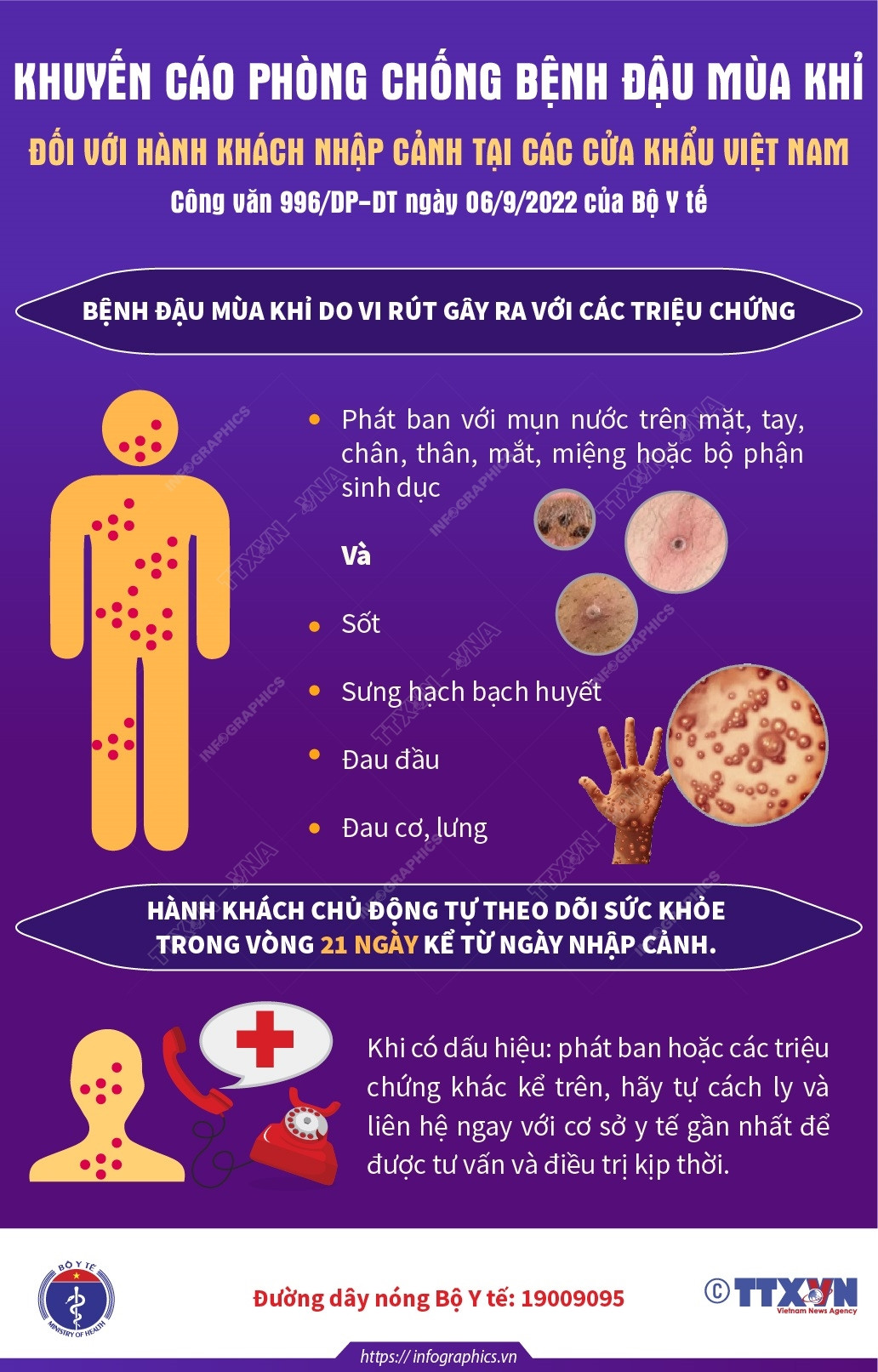 Khuyến cáo phòng chống đậu mùa khỉ với hành khách nhập cảnh Việt Nam ảnh 2