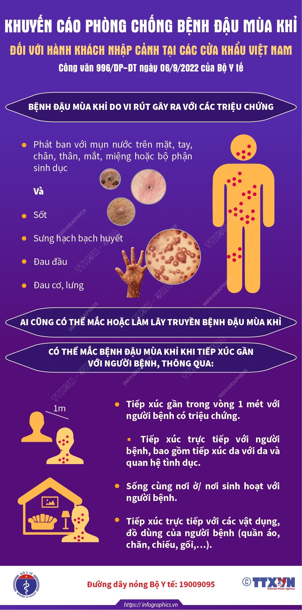 Khuyến cáo phòng chống đậu mùa khỉ với hành khách nhập cảnh Việt Nam ảnh 1