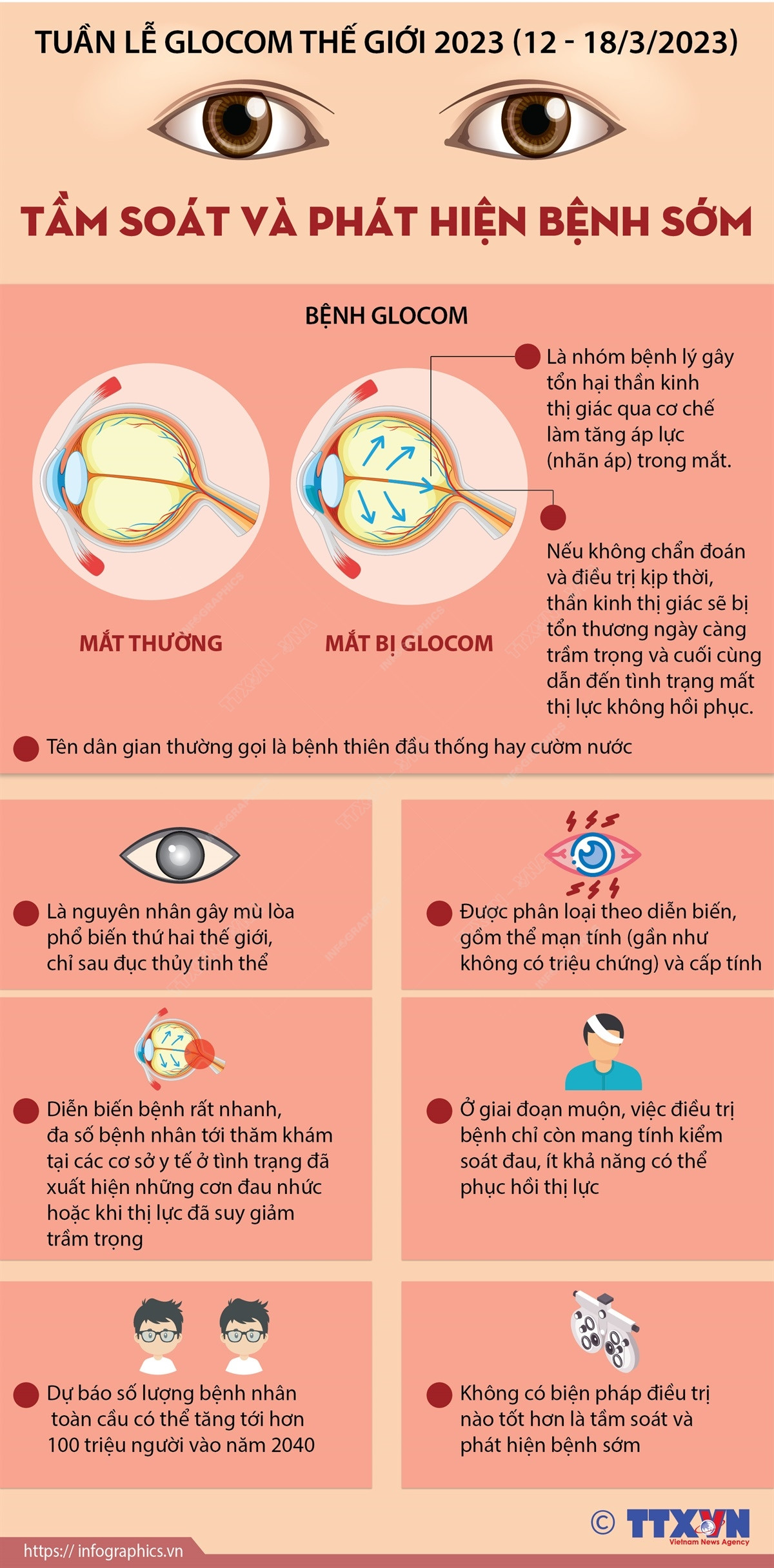 [Infographics] Tuần lễ Glocom Thế giới: Tầm soát và phát hiện bệnh sớm ảnh 1