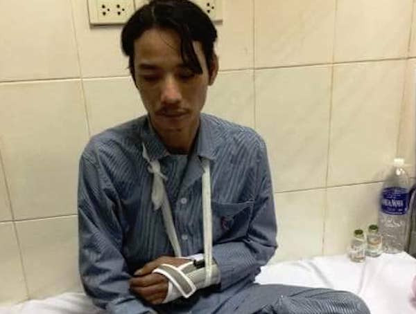 Hà Nội: Một công nhân vệ sinh môi trường bị hành hung gãy tay ảnh 1