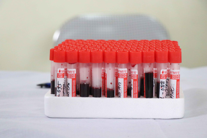 Vụ nhiễm sán lợn: Tỉnh xét nghiệm miễn phí, phụ huynh vẫn băn khoăn ảnh 1