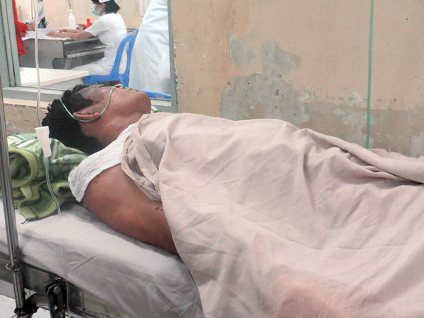 Nạn nhân vụ nổ tại Pomina 3 chưa qua cơn nguy kịch ảnh 1