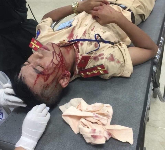 Hà Nội: Người vi phạm dùng đá đánh cảnh sát giao thông nhập viện ảnh 1