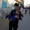 Em nhỏ bị thương do xung đột Hamas-Israel tại Rafah, Dải Gaza. (Ảnh: THX/TTXVN)