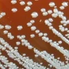 Vi khuẩn Burkholderia pseudomallei gây bệnh Whitmore. (Nguồn: CNN)