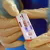 Kết quả xét nghiệm COVID-19. (Nguồn: Vietnam+)