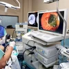 Bệnh viện đầu tiên ở miền Trung tán sỏi đường mật trong gan bằng laser