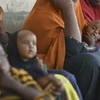 Trẻ em suy dinh dưỡng được điều trị tại Baidoa, Somalia. (Nguồn: AFP/TTXVN)