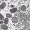 Hình ảnh virus đậu mùa khỉ được chiếu dưới kính hiển vi điện tử do Trung tâm kiểm soát và phòng ngừa dịch bệnh cung cấp. (Ảnh: AP/TTXVN) 