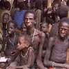 Nạn đói nghiêm trọng nhất thế giới tại Sudan 