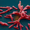 Hình ảnh vi khuẩn Burkholderia pseudomalei gây bệnh Whitmore. (Nguồn: Bộ Y tế)