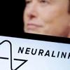 Logo Neuralink và tỷ phú Elon Musk. (Ảnh: China Daily)