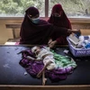 Nhân viên y tế điều trị cho em nhỏ bị suy dinh dưỡng tại bệnh viện ở Mogadishu, Somalia. (Ảnh: AFP/TTXVN)