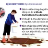 [Infographics] Điều cần biết về bệnh truyền nhiễm nguy hiểm Whitmore