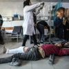 Điều trị cho người bị thương trong vụ tấn công của lực lượng Israel nhằm vào người dân Palestine chờ nhận hàng viện trợ nhân đạo tại thành phố Gaza, ở bệnh viện Kamal Edwan, ngày 29/2/2024. (Ảnh: AFP/TTXVN)