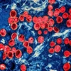 Hình ảnh virus đậu mùa khỉ dưới kính hiển vi. (Ảnh: Getty Images/TTXVN)