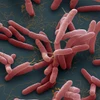 Vi khuẩn Burkholderia pseudomallei. (Nguồn: NPR)
