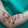 Bé trai 10 nhập viện trong tình trạng cơ thể có nhiều vết thương. (Ảnh: PV/Vietnam+)