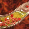 Các phát hiện mới liên quan tới lượng cholesterol trong máu