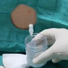 Các bác sỹ chọc dò dịch não tủy làm xét nghiệm đánh giá tình trạng viêm não màng não bệnh nhân.