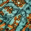 Các hạt virus cúm gia cầm H5N1 (màu cam) dưới kính hiển vi. (Nguồn: Statnews)