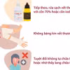 Cần làm gì ngay sau khi bị chó, mèo cắn để phòng bệnh dại?