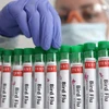 Bệnh nhân nam 59 tuổi, người Mexico, nhiễm virus cúm gia cầm H5N2 và đã qua đời ngày 24/4. (Ảnh minh họa. Nguồn: Reuters)
