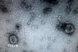 Các nhà nghiên cứu từ Đại học Y khoa Sechenov của Nga cảnh báo những người từng bị nhiễm virus SARS-CoV-2 đều có thể mắc một căn bệnh nguy hiểm: hoại tử xương. (Ảnh: TTXVN phát)