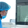 Bác sỹ Bệnh viện FV quan sát hình ảnh các mạch máu não quanh khối u trong quá trình làm tắc mạch. (Ảnh: TTXVN phát)