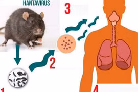 Ảnh chỉ mang tính minh họa. (Nguồn: suckhoedoisong)