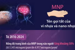 Cảnh báo rác nhựa xâm nhập não người 