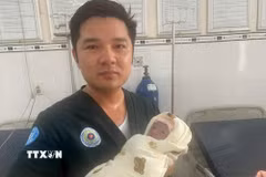 Đại úy Phạm Minh Trung, Tiểu đoàn trưởng, Tiểu đoàn Quân y Sư đoàn 4 cho biết các y, bác sỹ phối hợp với Trạm y tế địa phương tiến hành các biện pháp cấp cứu đúng quy trình, bảo đảm sức khỏe sản phụ và trẻ sơ sinh. (Ảnh: TTXVN phát)