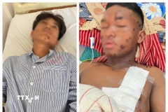 Hai nạn nhân được điều trị tại Khoa Ngoại tổng hợp, Bệnh viện Đa khoa tỉnh Gia Lai. (Ảnh: Hồng Điệp/TTXVN)
