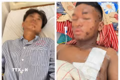 Hai nạn nhân được điều trị tại Khoa Ngoại tổng hợp, Bệnh viện Đa khoa tỉnh Gia Lai. (Ảnh: Hồng Điệp/TTXVN)