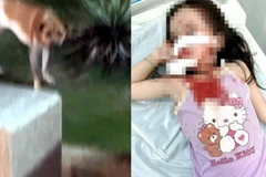 TP Hồ Chí Minh: Bé gái 4 tuổi bị chó tấn công, thương tích nghiêm trọng vùng mặt